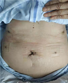 D:我的文档WeChat FilesjunqiufengFileStorageTempa269bc58a7764b9254483d4264d8da44.png