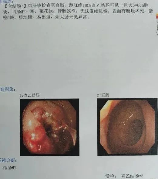 D:我的文档WeChat FilesjunqiufengFileStorageTemp87a584a022c84c81905fa2b1e81b89f.jpg