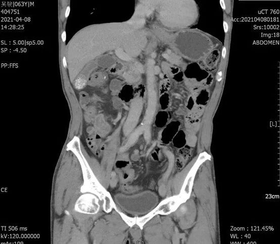 D:我的文档WeChat FilesjunqiufengFileStorageTempac6fb48ef687af256c68b00fad1988f.jpg