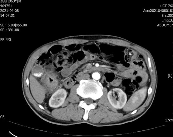 D:我的文档WeChat FilesjunqiufengFileStorageTempebd291eaa76c931a7407a90499ef1b6.jpg