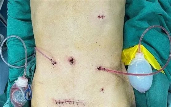 D:我的文档WeChat FilesjunqiufengFileStorageTemp8181865343953520de1669ed5491828.jpg