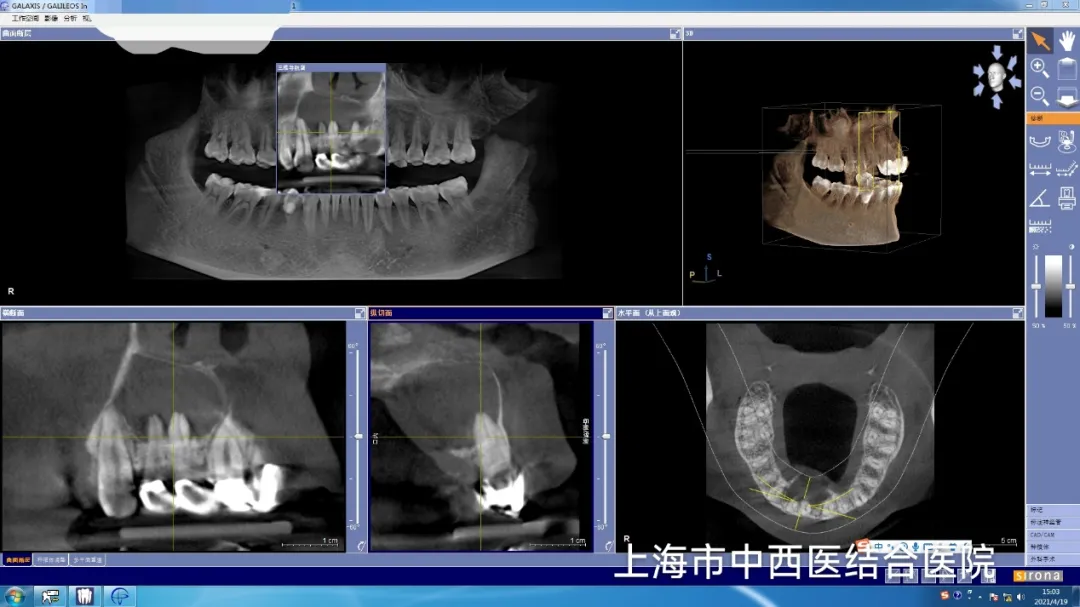 图片 5.png